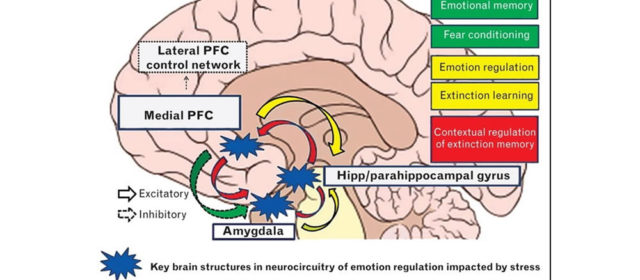 L’ansia può modificare il nostro cervello